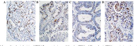 Figure 1 From Expression Of Chromosomal Regional Maintenance Protein 1