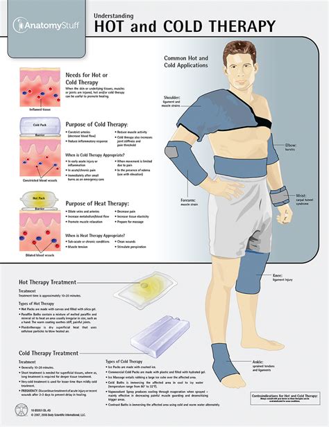 Hot And Cold Therapy Chart Poster Anatomystuff Ice Heat Treatment