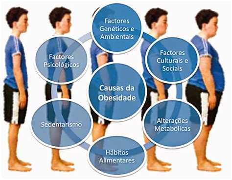 Atividade Fisica X Obesidade Obesidade Na Inf Ncia Pode Causar Doen As