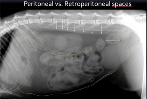 Abdominal Radiographs Minus Stomach Flashcards Quizlet