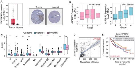 Expression Of Igf2bp3 Is Increased In Hcc And Is Positively Correlated Download Scientific