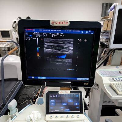 Used BIOSOUND Esaote MyLab Twice Shared Service Ultrasound For Sale