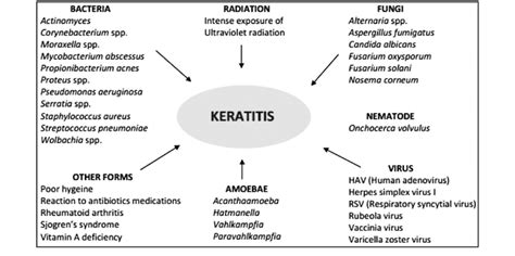 Major Categories Of Corneal Inflammation Keratitis Of Eyes Download Scientific Diagram