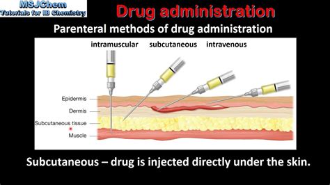 10 Routes Of Drug Administration