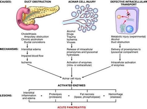 Acute Pancreatitis Case Discussion Epomedicine