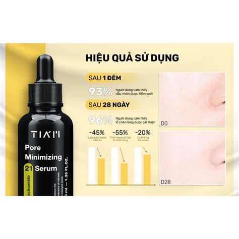 Mua Serum Niacinamide Zinc Thu Nh L Ch N L Ng Ki M So T D U