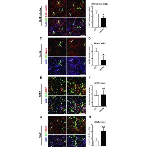 Lacuna Knockdown Promotes Differentiation Of Mouse Neural Stem Cells