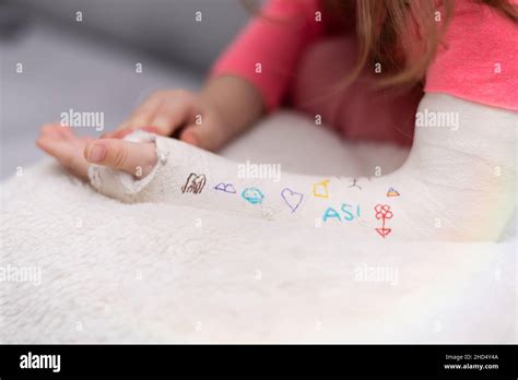 Niño niño con la pierna enyesada fotografías e imágenes de alta