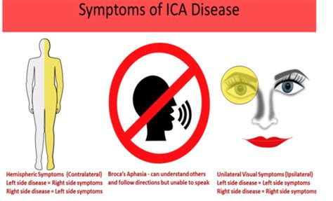 Signs And Symptoms Of Cerebrovascular Disease Flashcards Quizlet