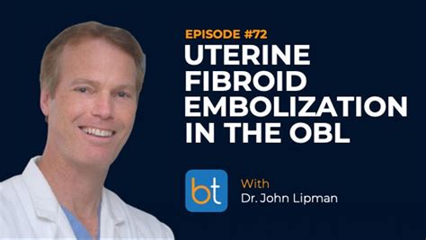 Uterine Fibroid Embolizations In The Obl Backtable Vi Podcast