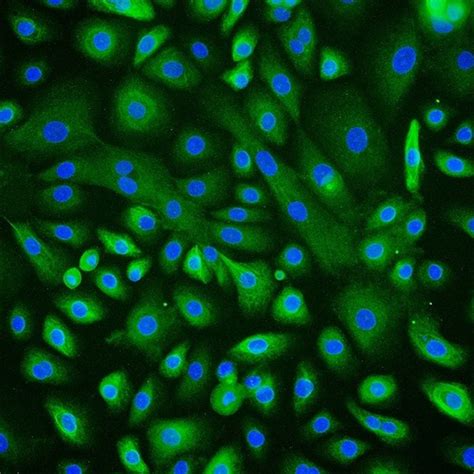 Human Corneal Epithelial Cells Innoprot Ocular Cell System