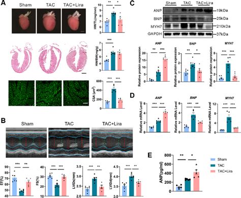 Liraglutide Alleviates Transverse Aortic Constriction TAC Induced