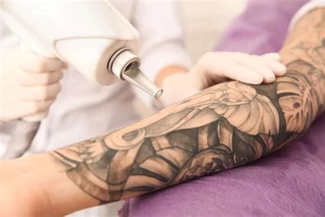 Méthode pour Enlever un Tatouage Lazeo