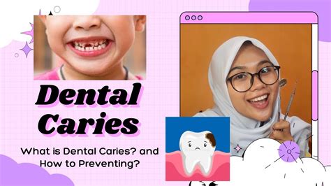 Dental Health Problem Ppt Dental Caries Dental Clinic