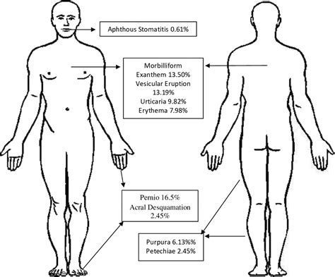 A Systematic Review Of Dermatologic Manifestations Among Adult Patients