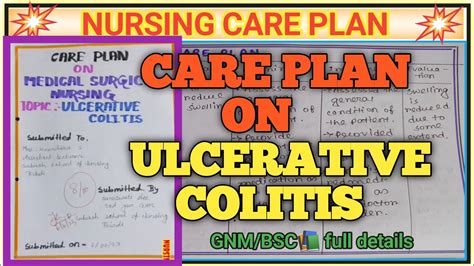 Care Plan On Ulcerative Colitis। Ncp Care Plan On Ulcerative Colitis। Ulcerativecolitis Ulcer