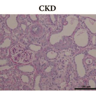 HDD Improved Renal Function In CKD Rats The Levels Of Scr A And BUN