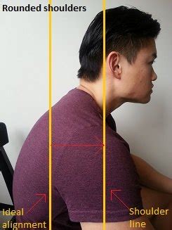 How To Fix Rounded Shoulders - Posture Direct