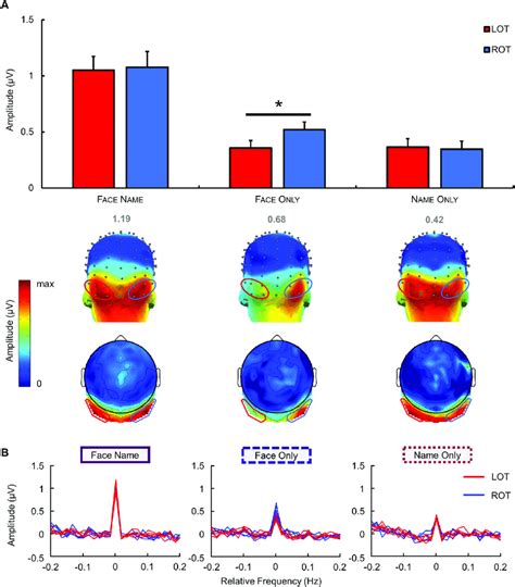 Quantification And Scalp Topography Of Eeg Responses In Each Condition