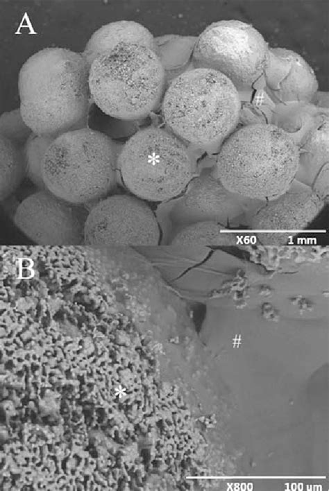 Figure 4 from Preparation of injectable 3 D formed β tricalcium