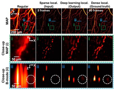 Artificial Intelligence Technology Accelerates Super Resolution