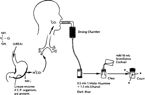 Figure 1 From Carbon 14 Urea Breath Test For The Diagnosis Of