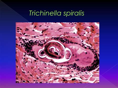 Phylum Nemathelminthes - ppt download