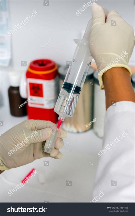 allografts images stock  vectors shutterstock