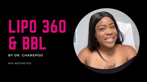 Lipo 360 And Bbl Testimonial By Dr Charepoo At Mia Aesthetics