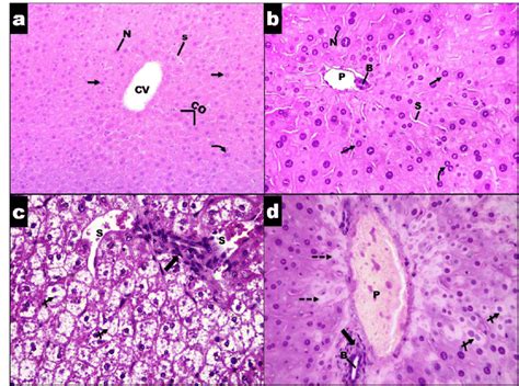 Photographs Of Hande Stained Lm Liver Sections X400 Of Adult Male Download Scientific Diagram