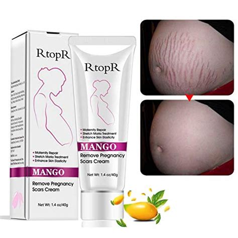 10 Best Pregnancy Stretch Mark Creams [2023 Updated Rankings] Glory Cycles