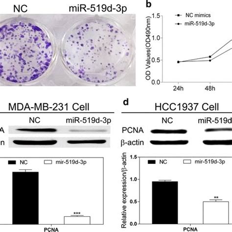 Mir D P Suppresses The Proliferation Of Breast Cancer Cells A