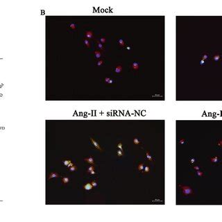 Reduction In Local Complement Activation With Gene Silencing Of Cfd In