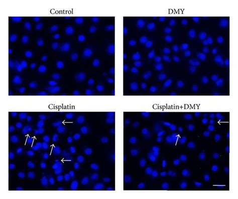 Dihydromyricetin Reduced Cell Apoptosis Caused By Cisplatin In Hk 2