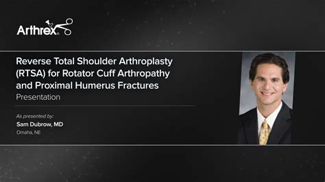 Arthrex Reverse Total Shoulder Arthroplasty RTSA For Rotator Cuff