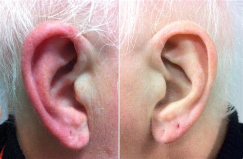 Figure 2 Ear Syndrome Ear Ache