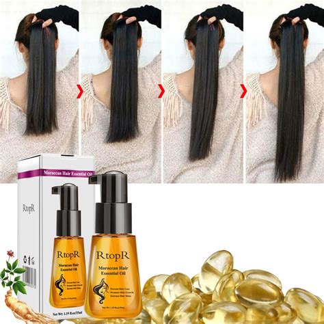 Moroccan Prevent Hair Loss Product Hair Growth Essential Gearbeauty