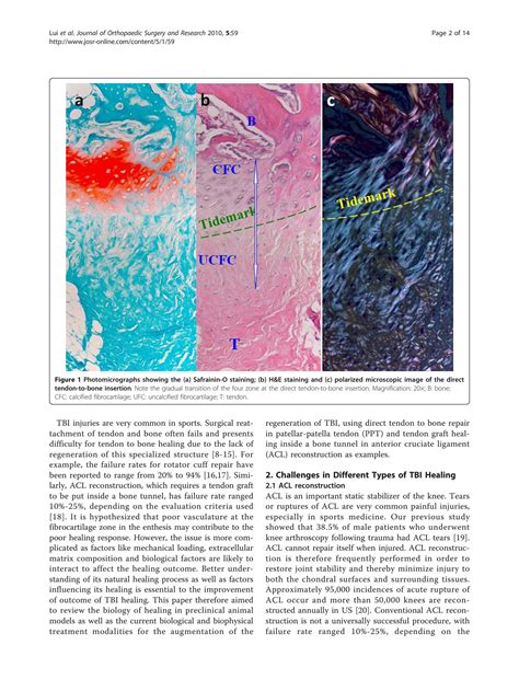 SOLUTION: Biology and augmentation of tendon bone insertion repair