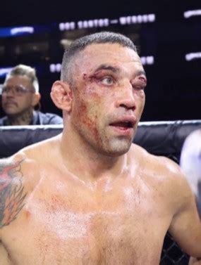 Former Ufc Heavyweight Champion Left With Brutal Eye Wound And Covered