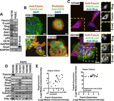 Slug Signaling Regulates Fascin Expression In Pdac Cells A Western