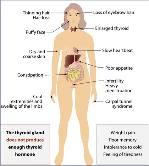 What Are The Symptoms Of An Overactive Or Underactive Thyroid Dr