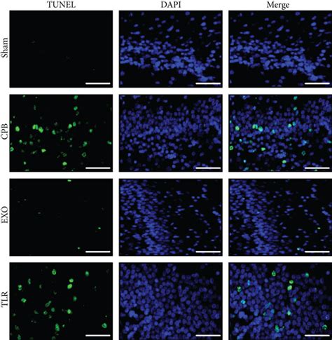 AMSC Derived Exosomes Prevented Neuronal Apoptosis In CPB Rats SPF SD