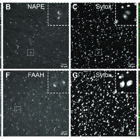 Double Label Immunofluorescence Illustrating The Co Localization Of Download Scientific Diagram