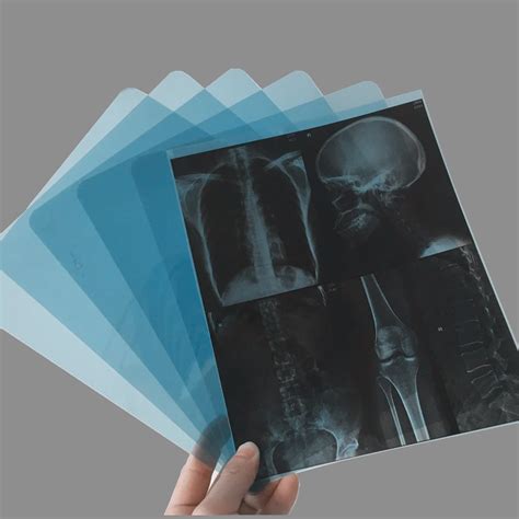 Radiographic Inkjet Medical X-ray Film Imaging 24x30 Cm / Blue X Ray Film - Buy Inkjet Printable ...