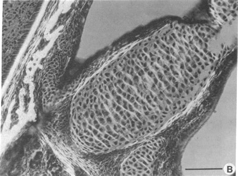 Polarized Light Microscopy Of A Section Of Nasal Septal Cartilage