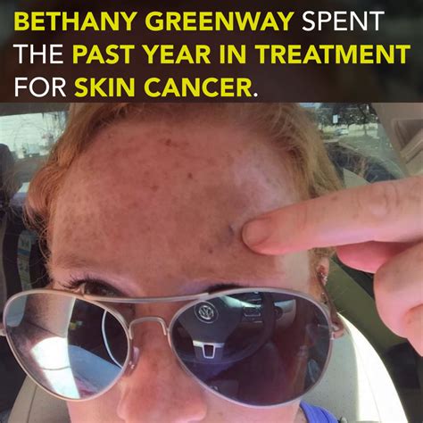 These Photos Show What A Year With Skin Cancer Looks Like The Mighty