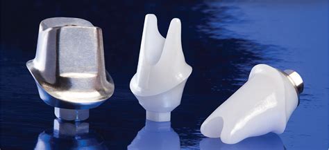 Customized Abutment