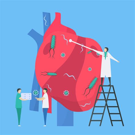 Infection Of Heart And Infection Removal Endocarditis Design 965479 Vector Art At Vecteezy