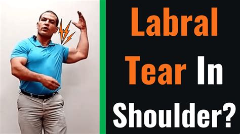 Shoulder Labral Tear Or Shoulder Joint Tear Treatment - vrogue.co