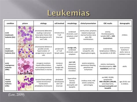 Ppt Leukemia Powerpoint Presentation Free Download Id 8923826